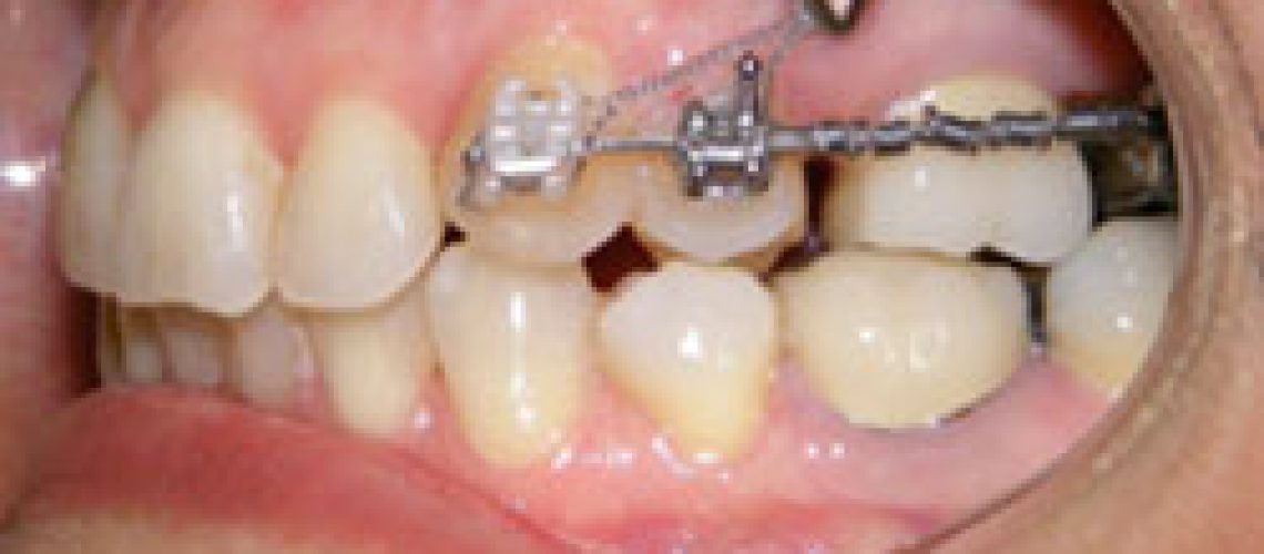 BLOG_1.15