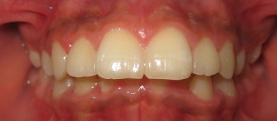 BLOG_10.13