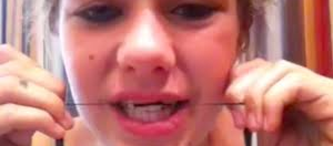 DIY-Braces