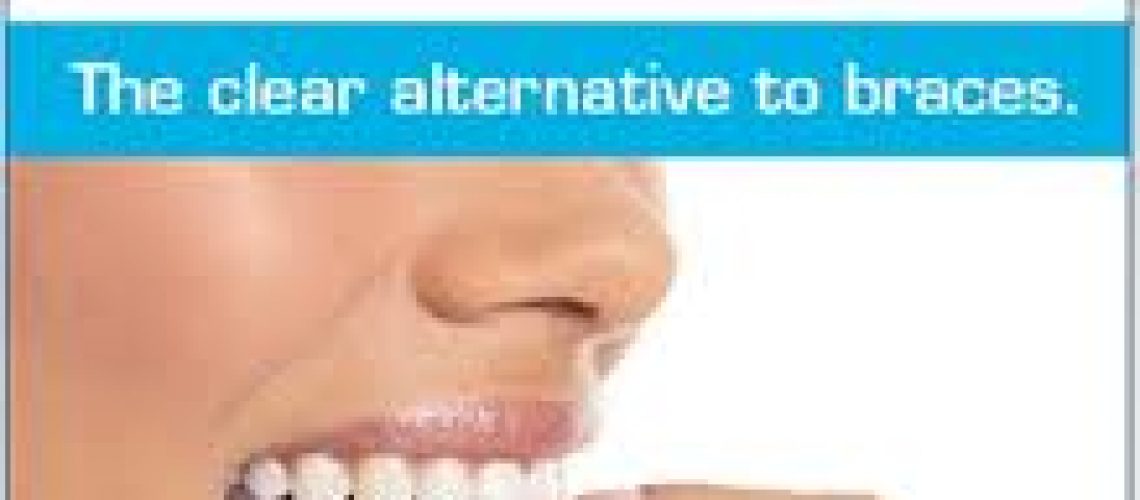Invisalign-tray