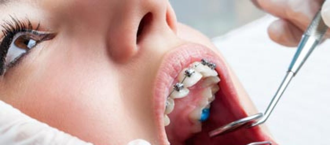 patient-with-braces